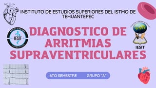 DIAGNOSTICO DE
ARRITMIAS
SUPRAVENTRICULARES
6TO SEMESTRE GRUPO “A”
INSTITUTO DE ESTUDIOS SUPERIORES DEL ISTMO DE
TEHUANTEPEC
 