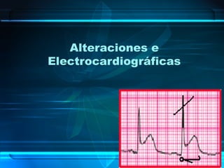 Alteraciones e
Electrocardiográficas
 