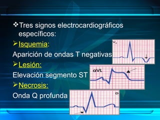 Tres signos electrocardiográficos
específicos:
Isquemia:
Aparición de ondas T negativas
Lesión:
Elevación segmento ST
Necrosis:
Onda Q profunda
 