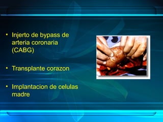 • Injerto de bypass de
arteria coronaria
(CABG)
• Transplante corazon
• Implantacion de celulas
madre
 