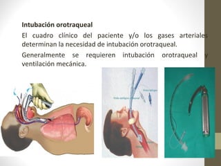 Intubación orotraqueal
El cuadro clínico del paciente y/o los gases arteriales
determinan la necesidad de intubación orotraqueal.
Generalmente se requieren intubación orotraqueal y
ventilación mecánica.
 