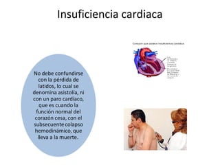 Insuficiencia cardiaca
 