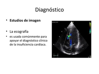 Diagnóstico
• Estudios de imagen
• La ecografía
• es usada comúnmente para
apoyar el diagnóstico clínico
de la insuficiencia cardíaca.
 
