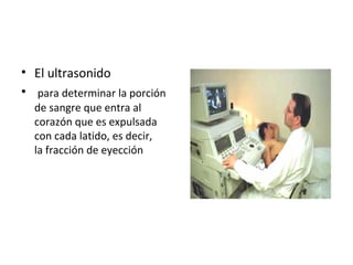• El ultrasonido
• para determinar la porción
de sangre que entra al
corazón que es expulsada
con cada latido, es decir,
la fracción de eyección
 