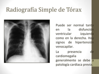 Radiografía Simple de Tórax
Puede ser normal tanto
en la disfunción
ventricular izquierda
como en la derecha. Hay
signos de hipertensión
venocapilar.
La presencia de
cardiomegalia
generalmente se debe a
patología cardiaca previa.
 