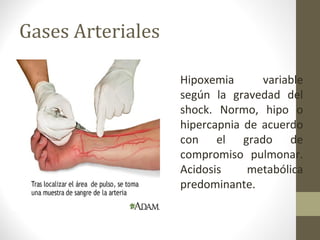 Gases Arteriales
Hipoxemia variable
según la gravedad del
shock. Normo, hipo o
hipercapnia de acuerdo
con el grado de
compromiso pulmonar.
Acidosis metabólica
predominante.
 