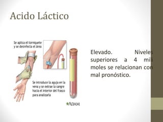 Acido Láctico
Elevado. Niveles
superiores a 4 mili
moles se relacionan con
mal pronóstico.
 