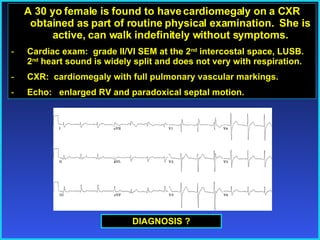 Atrial Septal Defect (ASD) A 30 yo female is found to have cardiomegaly on a CXR obtained as part of routine physical examination.  She is active, can walk indefinitely without symptoms. Cardiac exam:  grade II/VI SEM at the 2 nd  intercostal space, LUSB.  2 nd  heart sound is widely split and does not very with respiration. CXR:  cardiomegaly with full pulmonary vascular markings. Echo:  enlarged RV and paradoxical septal motion. DIAGNOSIS ? 