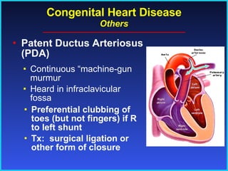 Congenital Heart Disease Others Patent Ductus Arteriosus (PDA) Preferential clubbing of toes (but not fingers) if R to left shunt Tx:  surgical ligation or other form of closure Continuous “machine-gun murmur Heard in infraclavicular fossa 