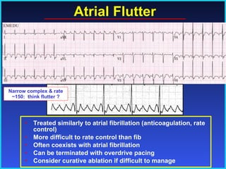 Atrial Flutter Treated similarly to atrial fibrillation (anticoagulation, rate control) More difficult to rate control than fib Often coexists with atrial fibrillation Can be terminated with overdrive pacing Consider curative ablation if difficult to manage Narrow complex & rate ~150:  think flutter ? 