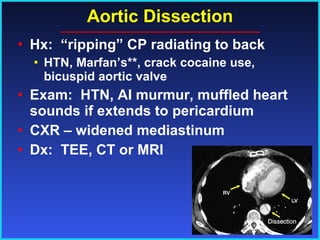 Aortic Dissection Hx:  “ripping” CP radiating to back HTN, Marfan’s**, crack cocaine use, bicuspid aortic valve Exam:  HTN, AI murmur, muffled heart sounds if extends to pericardium CXR – widened mediastinum Dx:  TEE, CT or MRI 