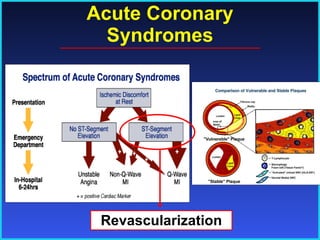 Acute Coronary Syndromes Revascularization 