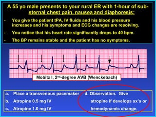 A 55 yo male presents to your rural ER with 1-hour of sub- sternal chest pain, nausea and diaphoresis: You give the patient tPA, IV fluids and his blood pressure increases and his symptoms and ECG changes are resolving. You notice that his heart rate significantly drops to 40 bpm. The BP remains stable and the patient has no symptoms. Place a transvenous pacemaker   d. Observation.  Give  Atropine 0.5 mg IV   atropine if develops sx’s or  Atropine 1.0 mg IV   hemodynamic change. Mobitz I, 2 nd -degree AVB (Wenckebach) 