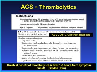 ACS  -   Thrombolytics Greatest benefit of thrombolytics in first 1-2 hours from symptom onset!  (Golden Hour) ABSOLUTE Contraindications 