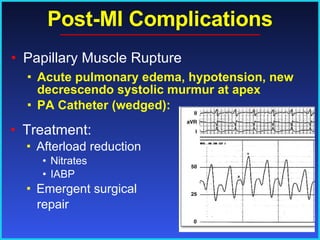 Post-MI Complications Acute pulmonary edema, hypotension, new decrescendo systolic murmur at apex PA Catheter (wedged):   Papillary Muscle Rupture  Treatment: Afterload reduction Nitrates IABP Emergent surgical repair 