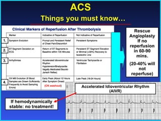 ACS   Things you must know… 1. 2. 3. 4. Rescue Angioplasty If no reperfusion in 60-90 mins. (20-40% will not reperfuse) If hemodynamically stable: no treatment! (CK washout ) Accelerated Idioventricular Rhythm (AIVR) 