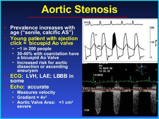 Aortic Stenosis Prevalence increases with age (“senile, calcific AS”) Young patient with ejection click =  bicuspid Ao valve ~1 in 200 people 30-40% with coarctation have a bicuspid Ao Valve Increased risk for aortic dissection or ascending aneurysm ECG :  LVH, LAE; LBBB in some Echo :  accurate Measures velocity Gradient = 4v 2 Aortic Valve Area:  <1 cm 2  severe 
