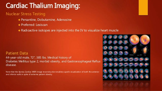 Cardiology 101 back to the basics