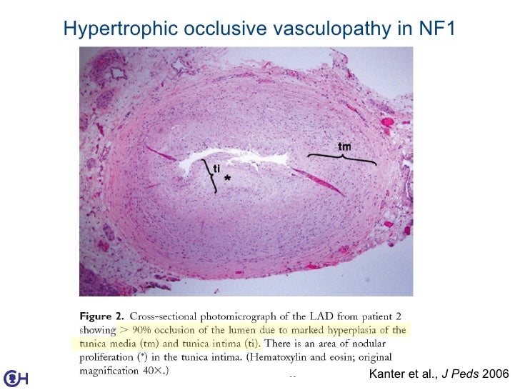 Rascuing the Heart (Cardiology 2011)