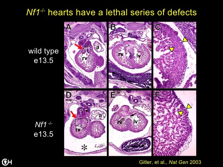 Rascuing the Heart (Cardiology 2011)