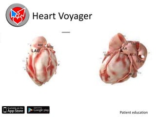 Heart Voyager
Patient education
 