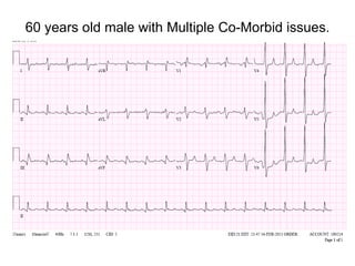 60 years old male with Multiple Co-Morbid issues.