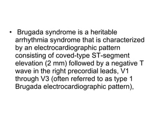 Brugada syndrome is a heritable arrhythmia syndrome that is characterized by an electrocardiographic pattern consisting of coved-type ST-segment elevation (2 mm) followed by a negative T wave in the right precordial leads, V1 through V3 (often referred to as type 1 Brugada electrocardiographic pattern),