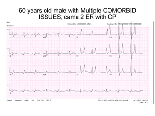 60 years old male with Multiple COMORBID ISSUES, came 2 ER with CP