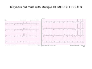 60 years old male with Multiple COMORBID ISSUES