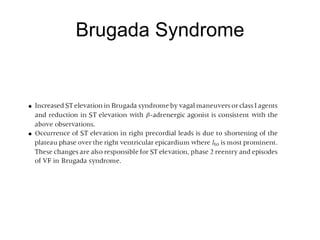 Brugada Syndrome 