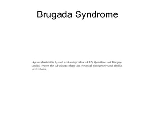 Brugada Syndrome 