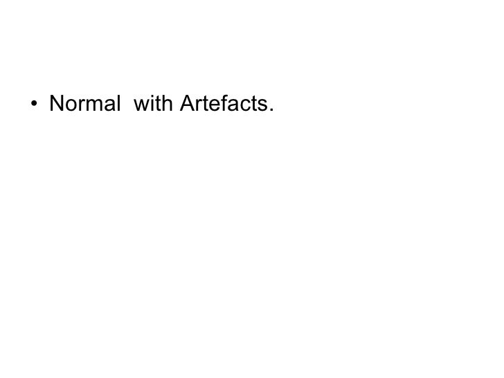 artifact meaning in cardiology