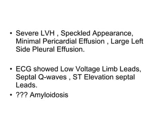 Severe LVH , Speckled Appearance, Minimal Pericardial Effusion , Large Left Side Pleural Effusion. ECG showed Low Voltage Limb Leads, Septal Q-waves , ST Elevation septal Leads. ??? Amyloidosis 