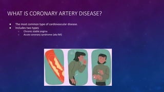 WHAT IS CORONARY ARTERY DISEASE?
● The most common type of cardiovascular disease.
● Includes two types
○ Chronic stable a...