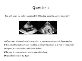Question-4
4) In a 30 years old male, regarding ECHO finding mark the correct statement?
A)Concentric left ventricular hypertrophy in a patient with systemic hypertension
B)It is an autosomal dominant condition in which the patient is at risk of ventricular
arrthymia, sudden cardiac death, heart failure
C)Benign lipomatous septal hypertrophy of the heart
D)Rhabdomyoma of the heart
 