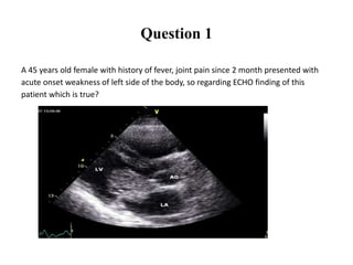 Question 1
A 45 years old female with history of fever, joint pain since 2 month presented with
acute onset weakness of left side of the body, so regarding ECHO finding of this
patient which is true?
 