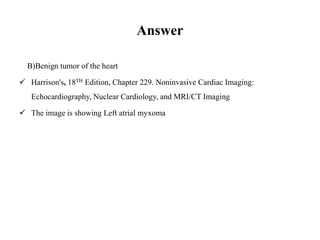 Answer
B)Benign tumor of the heart
Harrison's, 18TH Edition, Chapter 229. Noninvasive Cardiac Imaging:
Echocardiography, Nuclear Cardiology, and MRI/CT Imaging
The image is showing Left atrial myxoma
 