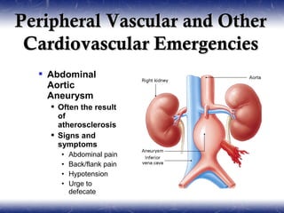 Peripheral Vascular and Other
 Cardiovascular Emergencies
   Abdominal
    Aortic
    Aneurysm
     Often the result
      of
      atherosclerosis
     Signs and
      symptoms
      •   Abdominal pain
      •   Back/flank pain
      •   Hypotension
      •   Urge to
          defecate
 