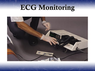 ECG Monitoring
 