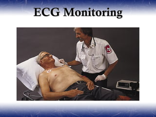 ECG Monitoring
 