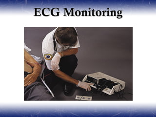 ECG Monitoring
 