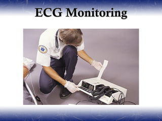 ECG Monitoring
 