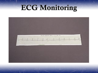 ECG Monitoring
 