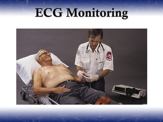 ECG Monitoring
 