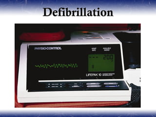 Defibrillation
 