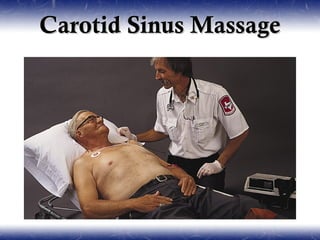 Carotid Sinus Massage
 