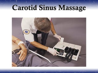 Carotid Sinus Massage
 