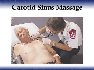 Carotid Sinus Massage
 
