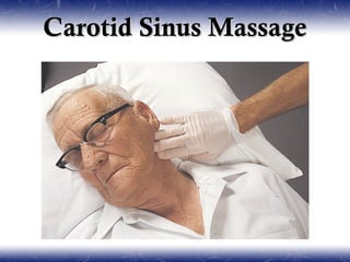Carotid Sinus Massage
 