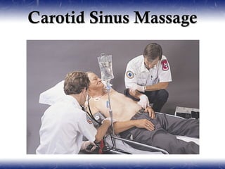 Carotid Sinus Massage
 